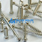 Cancellous Screws